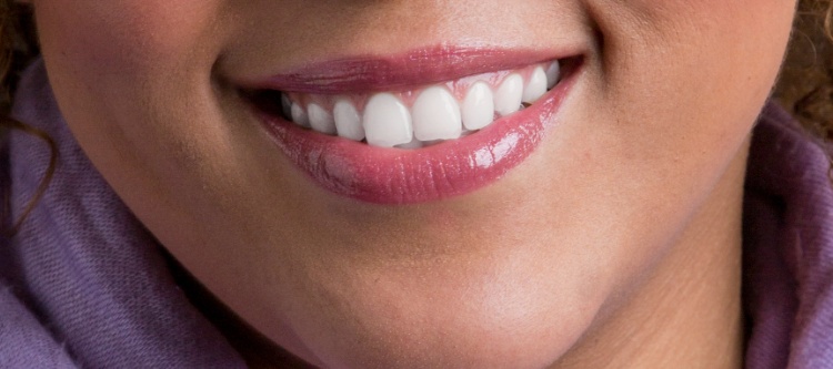 capture: Retouche des dents dans Photoshop, résultat final